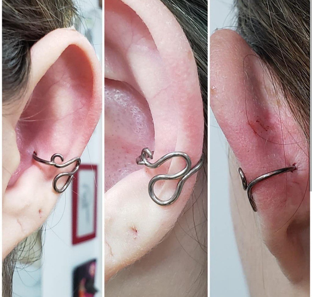 1dxkyickxdm2fx98zor94cq