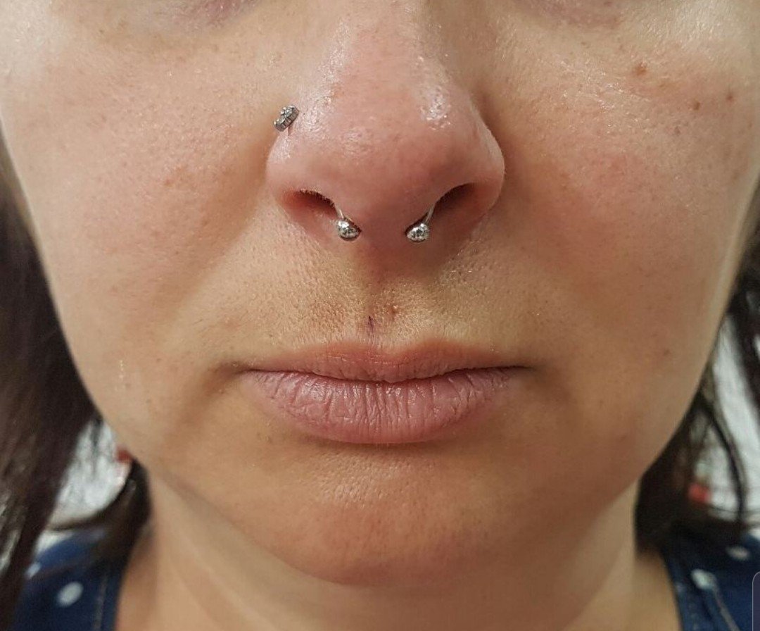 1yym-qsuz2fbffobxci57kg 1yym