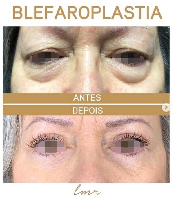 via-draalicevarandapereir-7-katrix-katrix via draalicevarandapereir 7 katrix