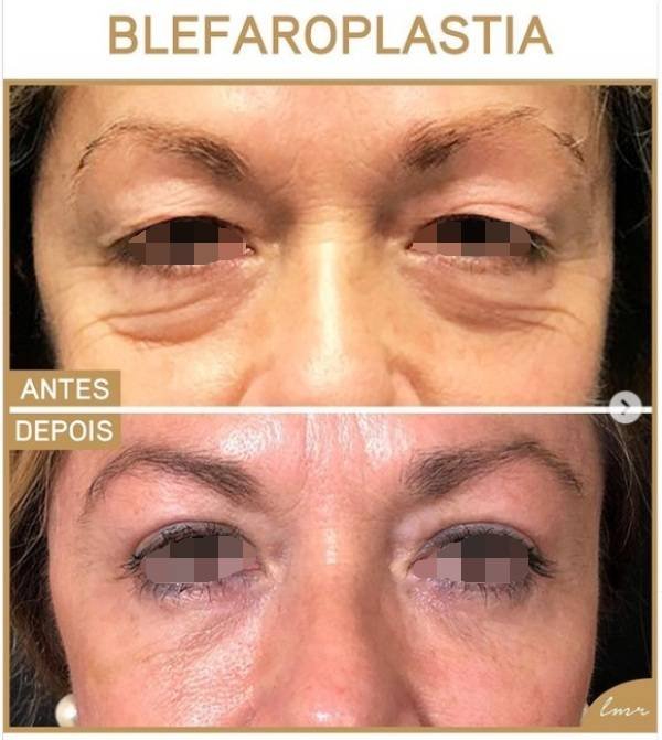 via-draalicevarandapereira-3-katrix-katrix via draalicevarandapereira 3 katrix