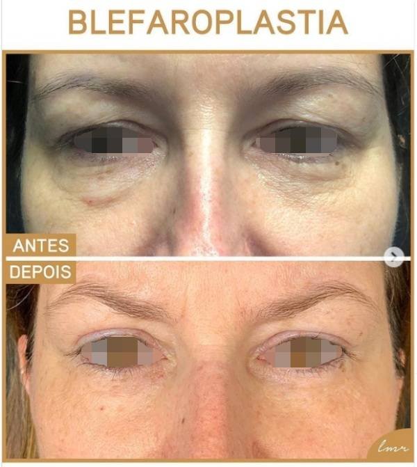 via-draalicevarandapereira-4-katrix-katrix via draalicevarandapereira 4 katrix