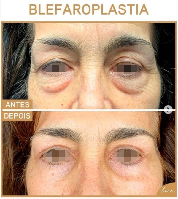 via-draalicevarandapereira-5-katrix-katrix via draalicevarandapereira 5 katrix