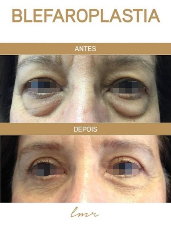 via-draalicevarandapereira-7-katrix-katrix via draalicevarandapereira 7 katrix