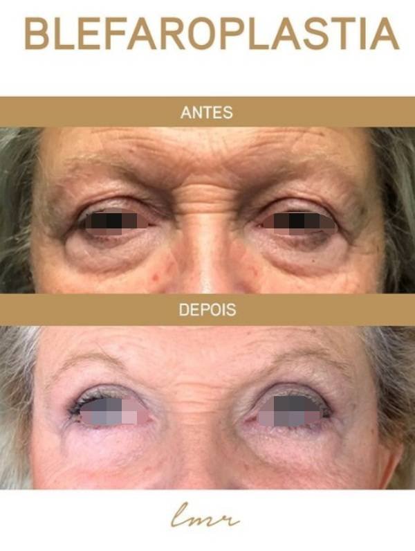 via-draalicevarandapereira-8-katrix-katrix via draalicevarandapereira 8 katrix