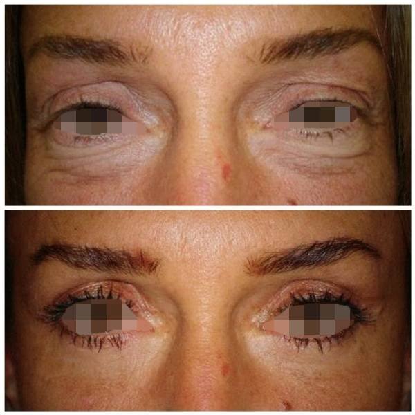 via-www-euealice-com_-br-katrix-katrix via www euealice com br katrix