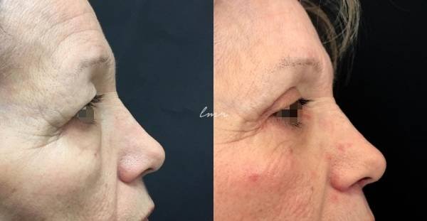 via-www-lmrcirurgiaplastica-pt-katrix-katrix via www lmrcirurgiaplastica pt katrix